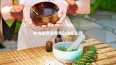 喉咙发痒咳嗽有白痰怎么办