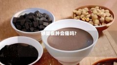 卵巢囊肿会痛吗?