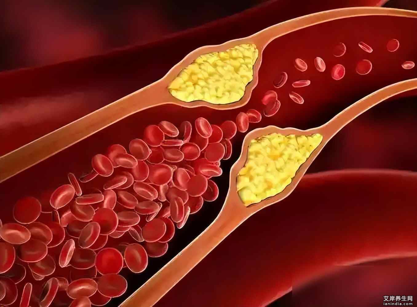 体检报告吓一跳，一粒花生毁健康，医生话里有话